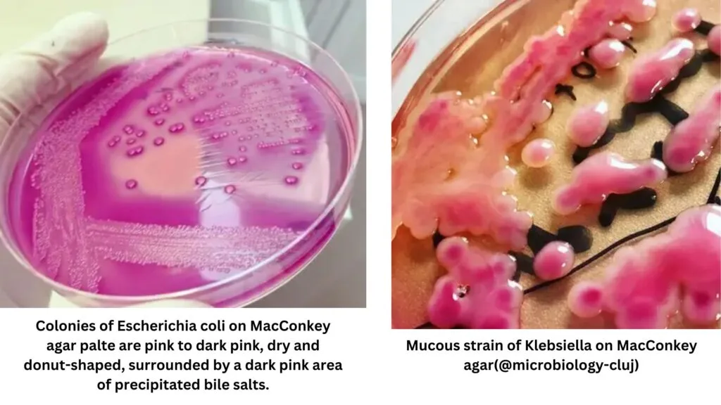 MacConkey Agar