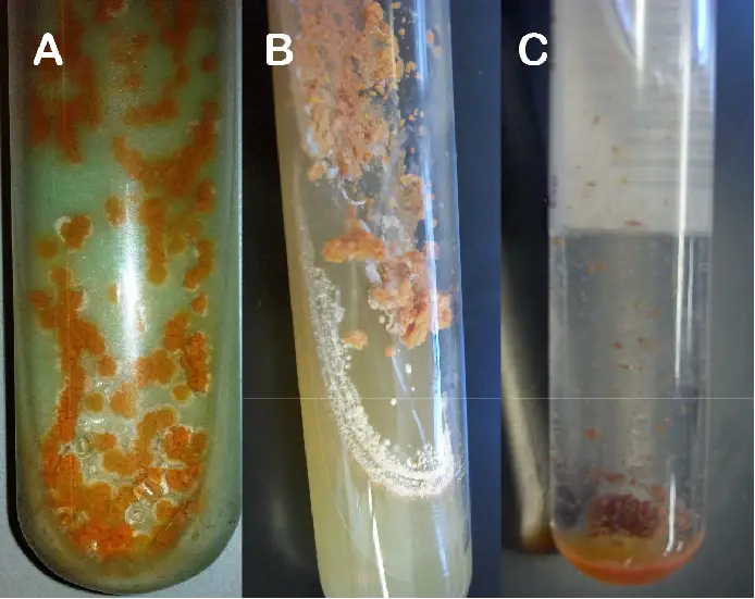 Macroscopic growth of Nocardia sp. in: A) Lowenstein Jensen medium, B) Agar Sabouraud and C) Bactec MGIT medium.