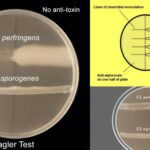 Nagler Reaction - Lecithinase Test