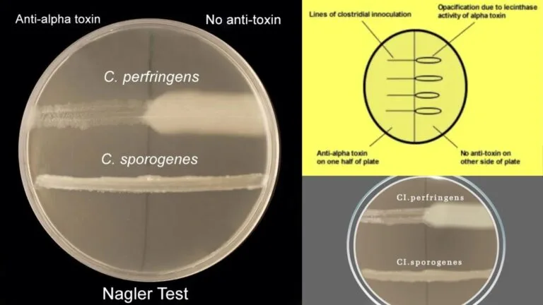 Nagler Reaction - Lecithinase Test