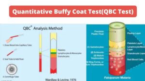 Quantitative Buffy Coat Test (QBC Test)