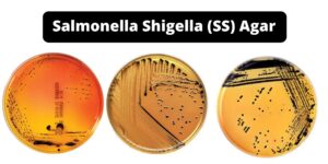 Salmonella Shigella Agar (SS Agar) – Principle, Composition, Application