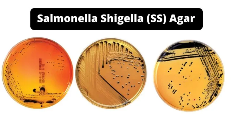 Salmonella Shigella (SS) Agar Principle, Composition, Application