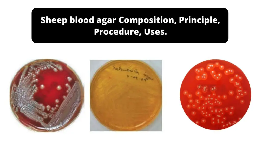 Sheep blood agar - Composition, Principle, Procedure, Uses. - Biology ...