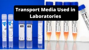 Transport Media – Definition, Types, Principle, Uses, Examples