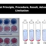 Widal Test Principle, Procedure, Result, Advantages, Limitation