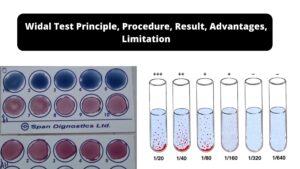 Widal Test – Principle, Procedure, Result, Advantages, Limitation