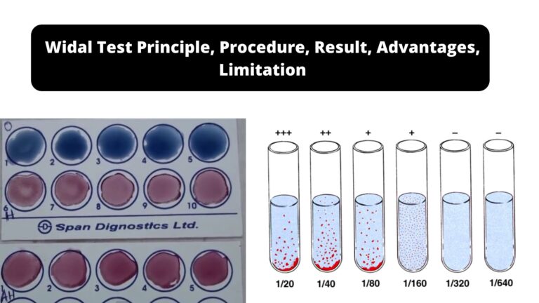 Most Probable Number (MPN) Test - Principle, Procedure, Results ...