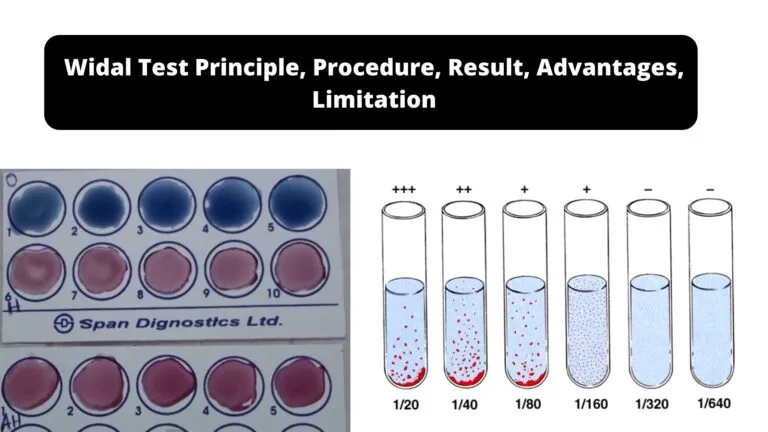 Widal Test Principle, Procedure, Result, Advantages, Limitation