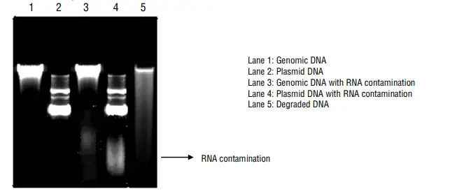 Observation and Result of Agarose Gel Electrophoresis