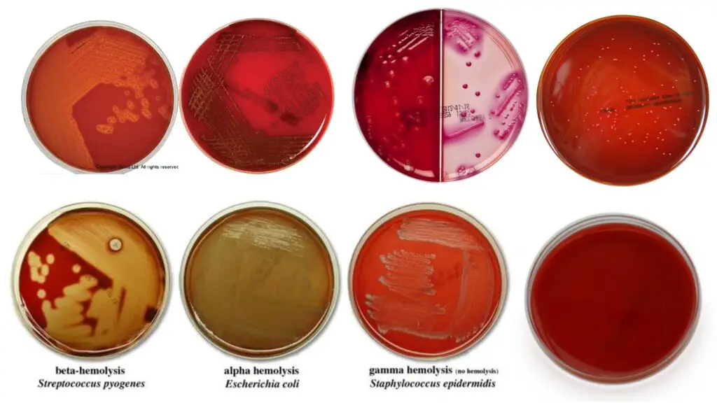 Blood Agar - Preparation, Composition, Application, and limitation ...