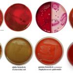 Blood Agar Definition, Preparation, Composition, Application, and limitation.