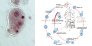 Entamoeba Histolytica – Morphology, Life Cycle, Prevalence, Epidemiology, Pathogenicity, Diagnosis, Prophylaxis and Treatment