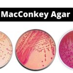 MacConkey Agar Composition, Uses, Colony Characteristics