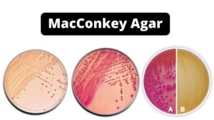 MacConkey Agar – Composition, Uses, Colony Characteristics