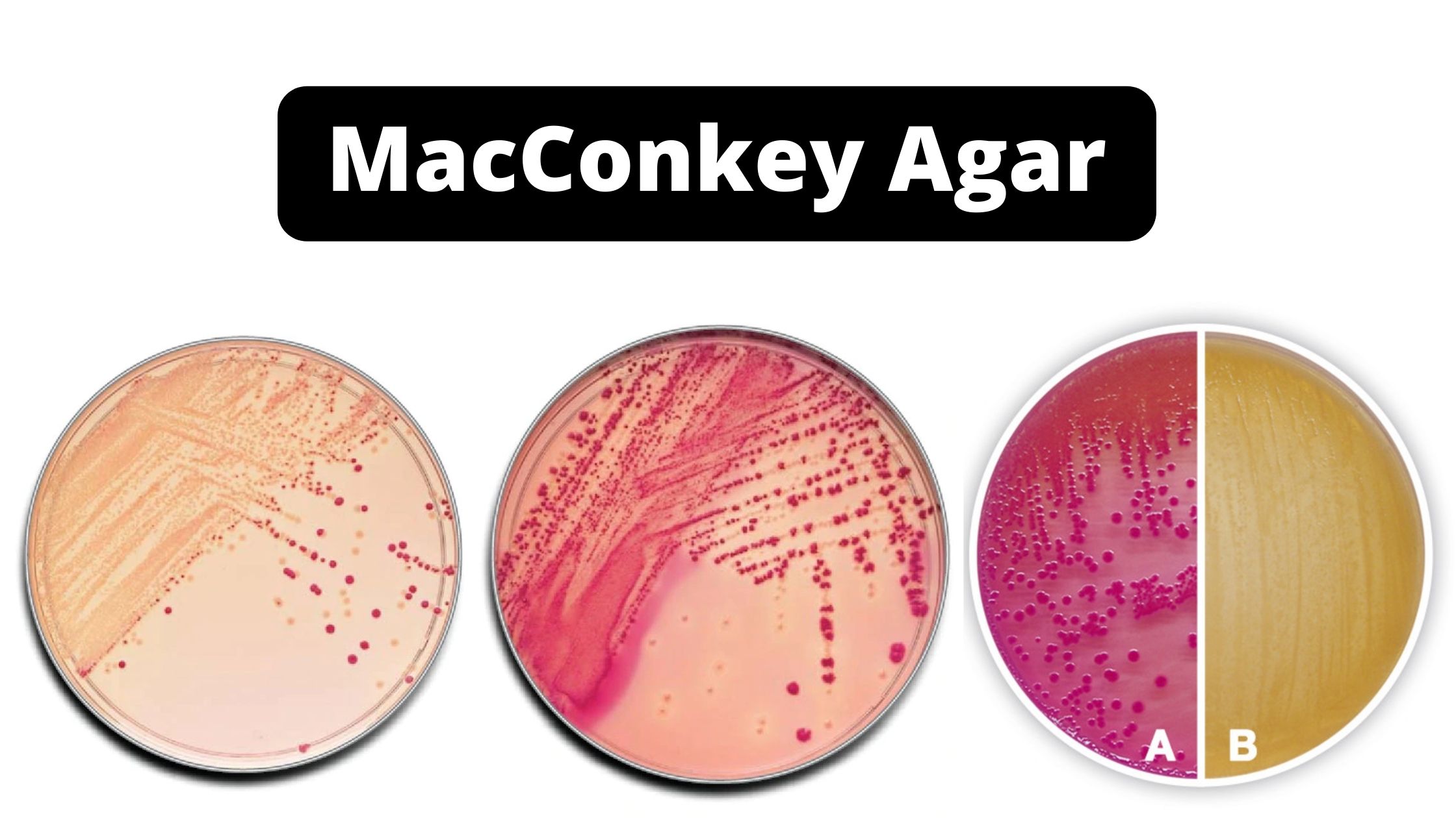 MacConkey Agar Composition, Uses, Colony Characteristics