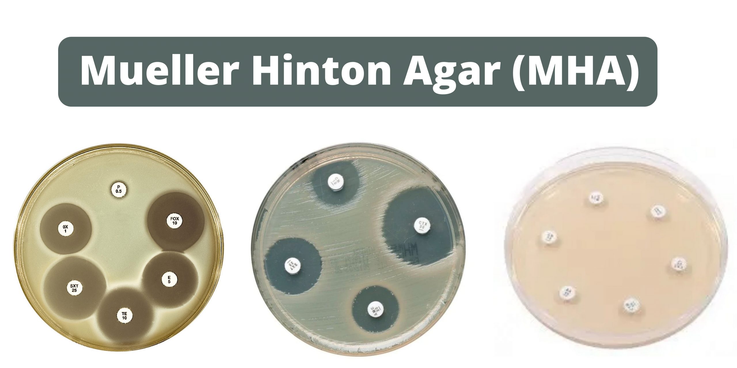 Mueller Hinton Agar (MHA) Composition, Principle, Preparation