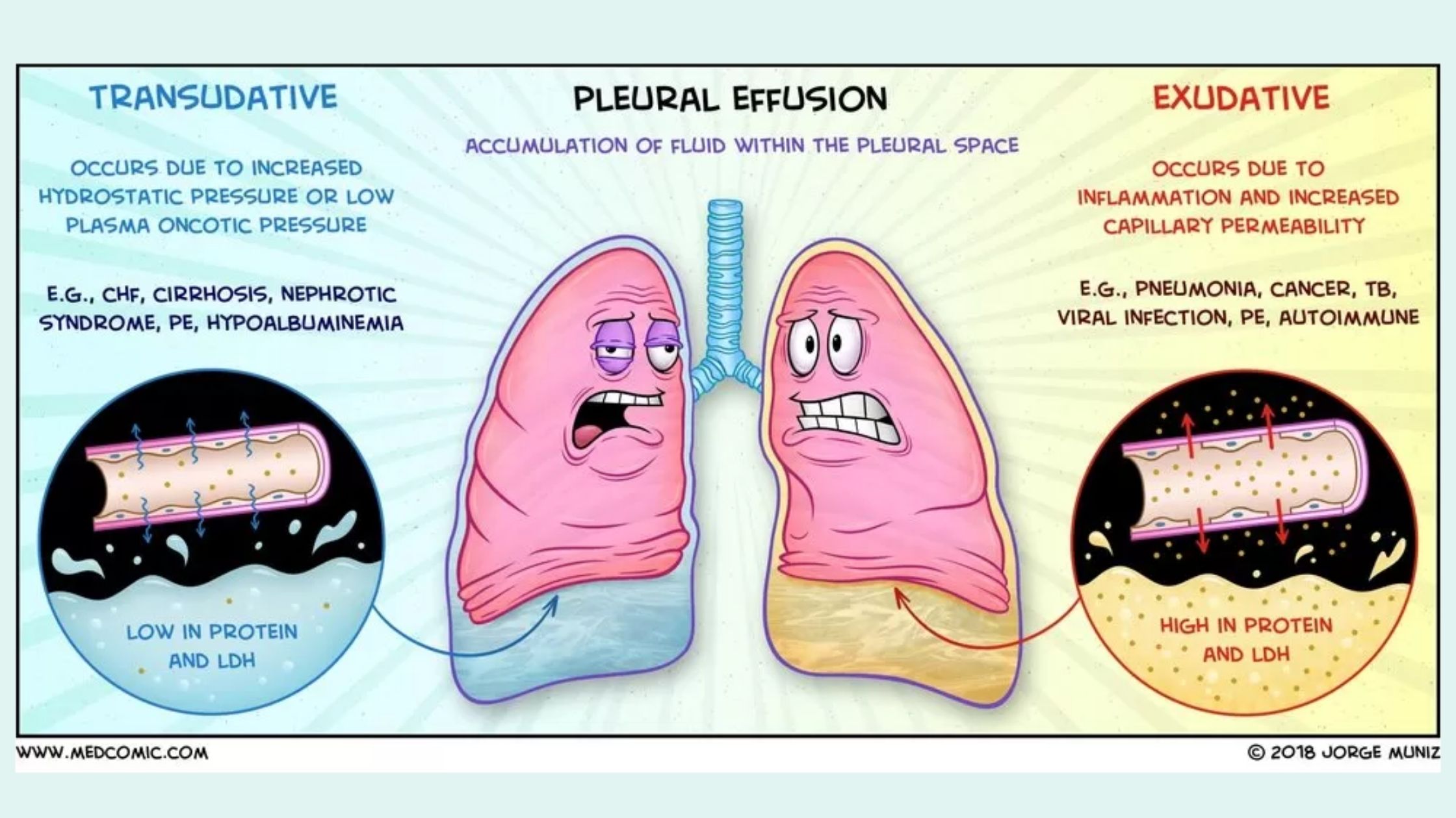 19 Differences Between Transudates and Exudates