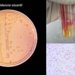 Biochemical Test of Providencia stuartii