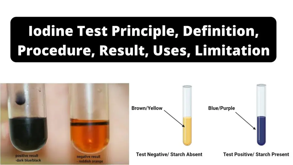 Iodine Test - Iodine test for starch Principle, Procedure, Result, Uses ...