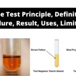 Iodine Test - Iodine test for starch Principle, Procedure, Result, Uses