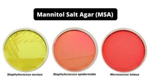 Mannitol Salt Agar (MSA) – Composition, Principle, Preparation, Results, Uses