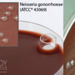 Martin Lewis Agar Composition, Preparation, Principle, Uses