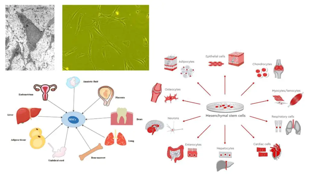 Mesenchymal Stromal Cells - Definition, Structure, Location, and ...