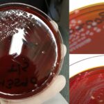 New York City Agar Composition, Preparation, Result, Uses