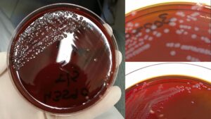 New York City Agar – Composition, Preparation, Result, Uses