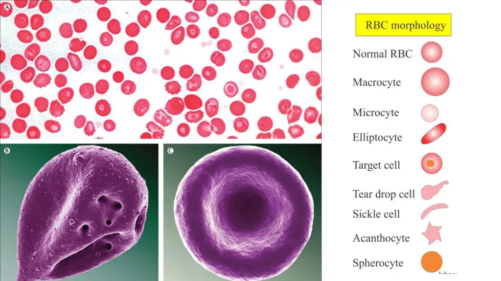 Red Blood Cell - Morphology, Size, Shape, Color and Inclusion Bodies ...