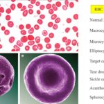 Red Blood Cell Morphology: Size, Shape, Color and Inclusion Bodies