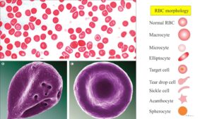 Red Blood Cell – Morphology, Size, Shape, Color and Inclusion Bodies