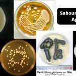 Sabouraud Dextrose Agar (SDA) - Composition, Preparation, Principle, Uses, Results