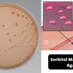 Sorbitol MacConkey Agar - Composition, Preparation and Uses