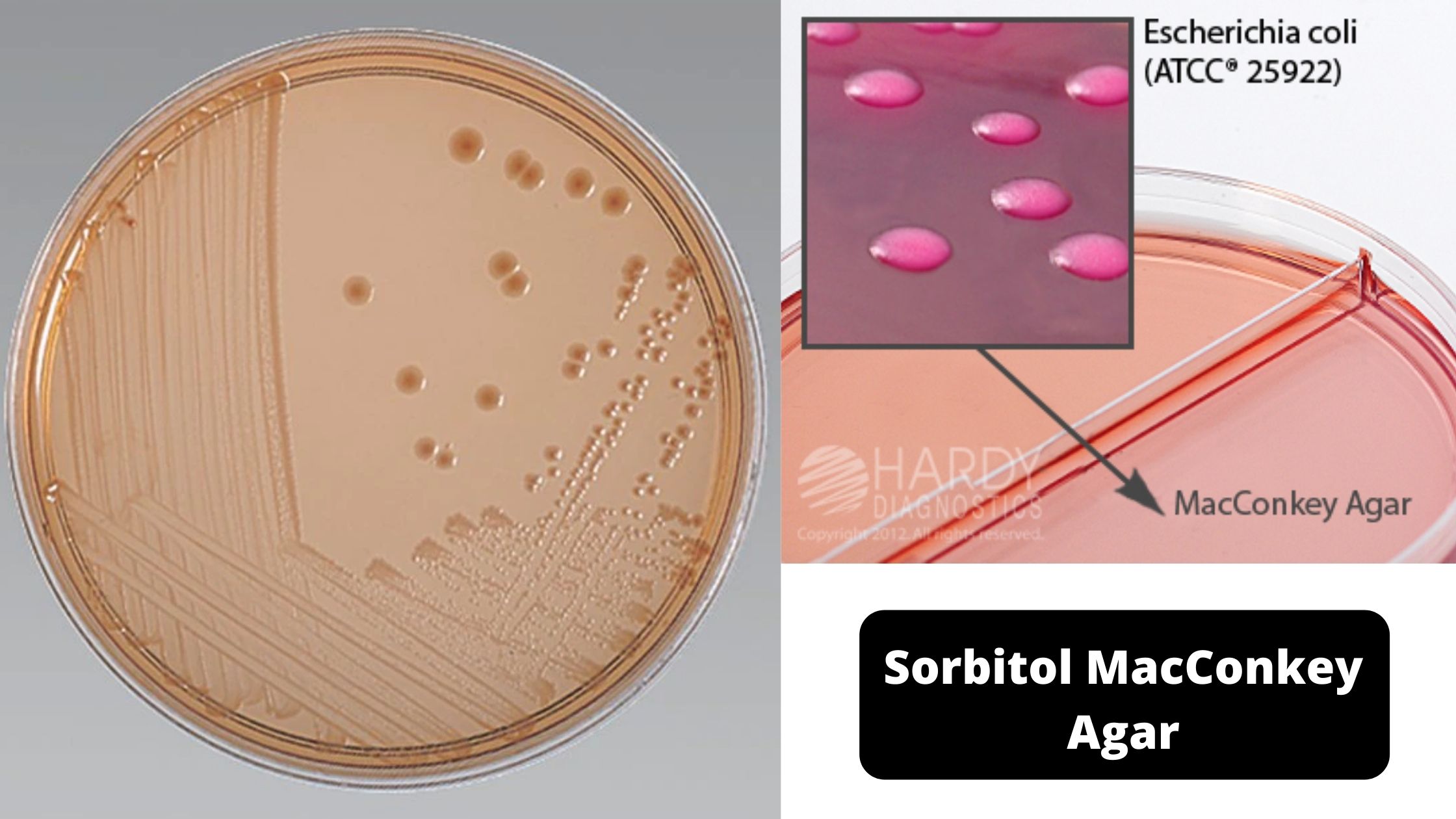 Sorbitol MacConkey Agar - Composition, Preparation and Uses