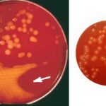 Streptococcus Selective Agar - Composition, Preparation, and Principle