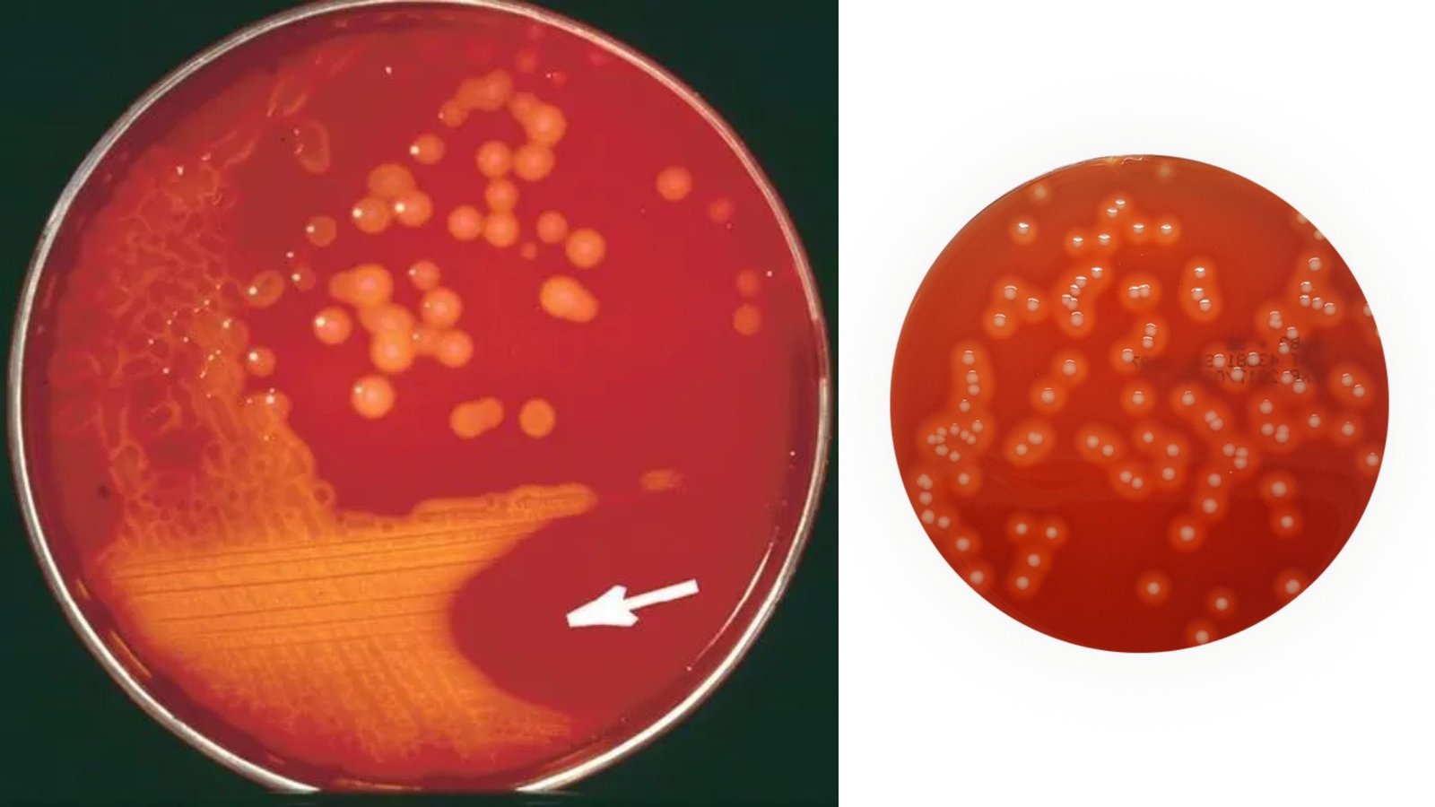 Streptococcus Selective Agar - Composition, Preparation, and Principle