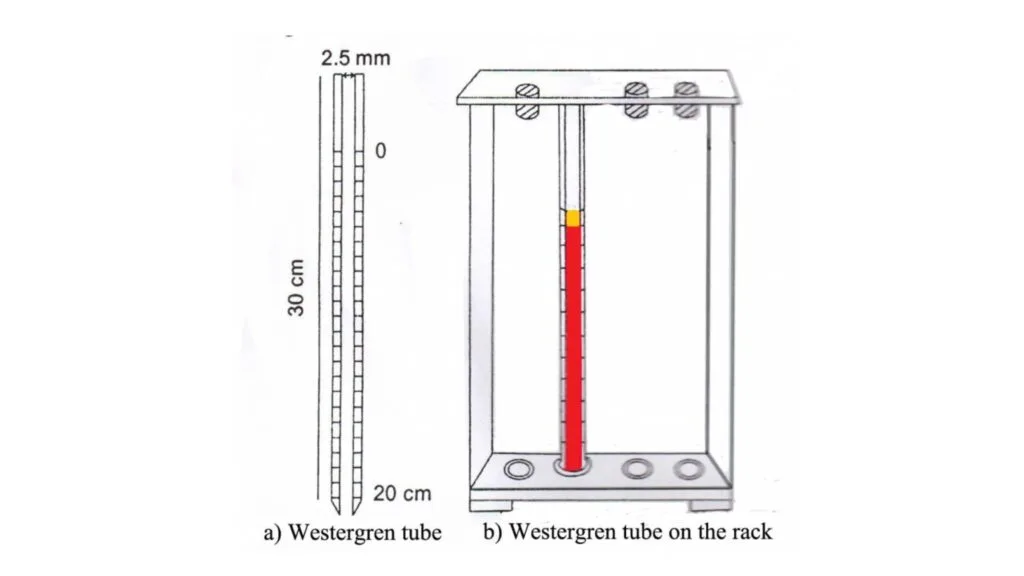 Westergren’s method of Erythrocyte Sedimentation Rate (ESR) 
