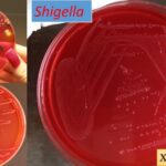 Xylose Lysine Deoxycholate (XLD) Agar Composition, Preparation, Principle, Uses