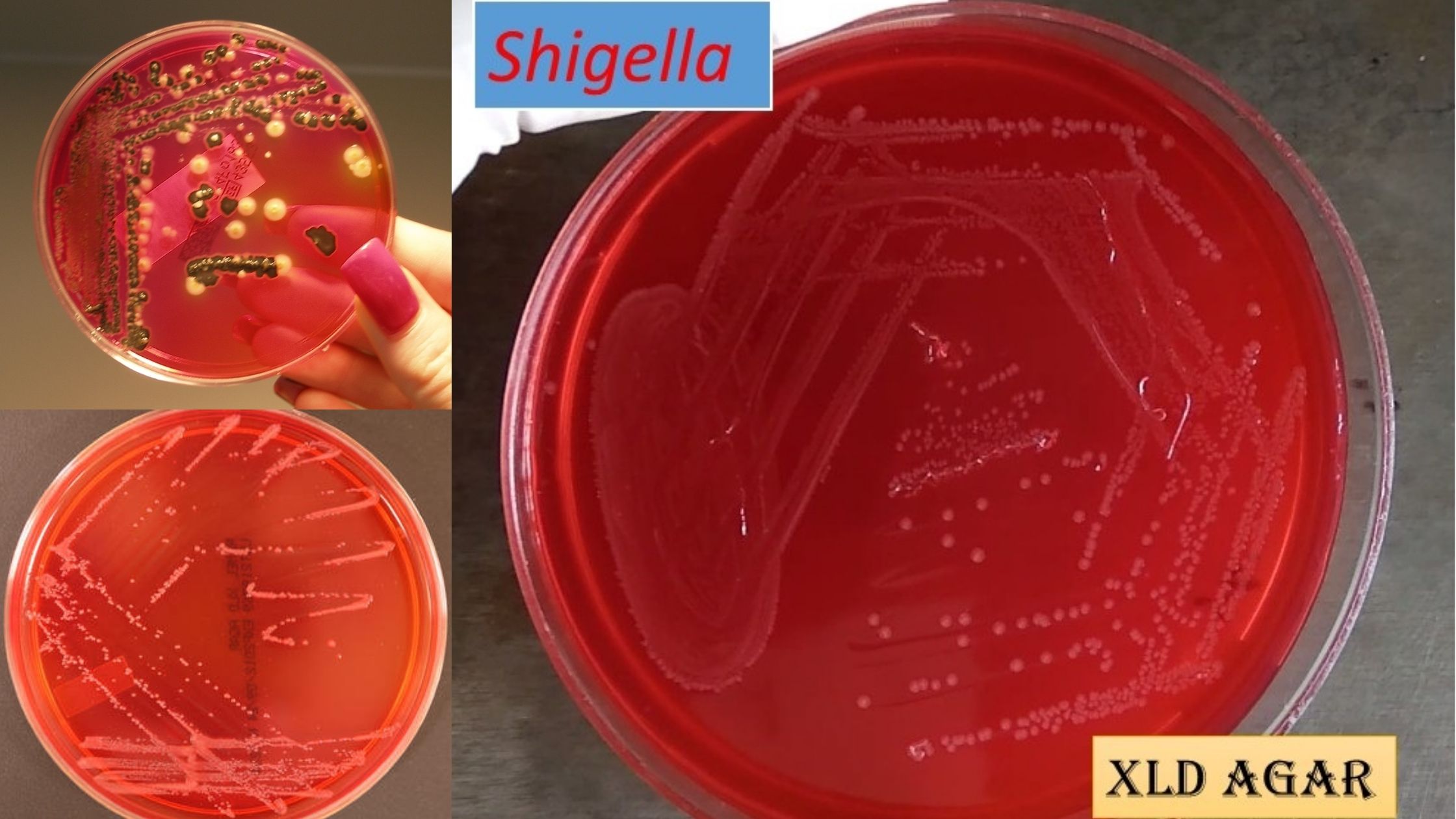 Xylose Lysine Deoxycholate (XLD) Agar Composition, Preparation, Principle, Uses