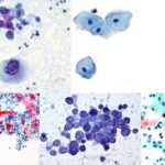 Papanicolaou Staining (Pap stain)