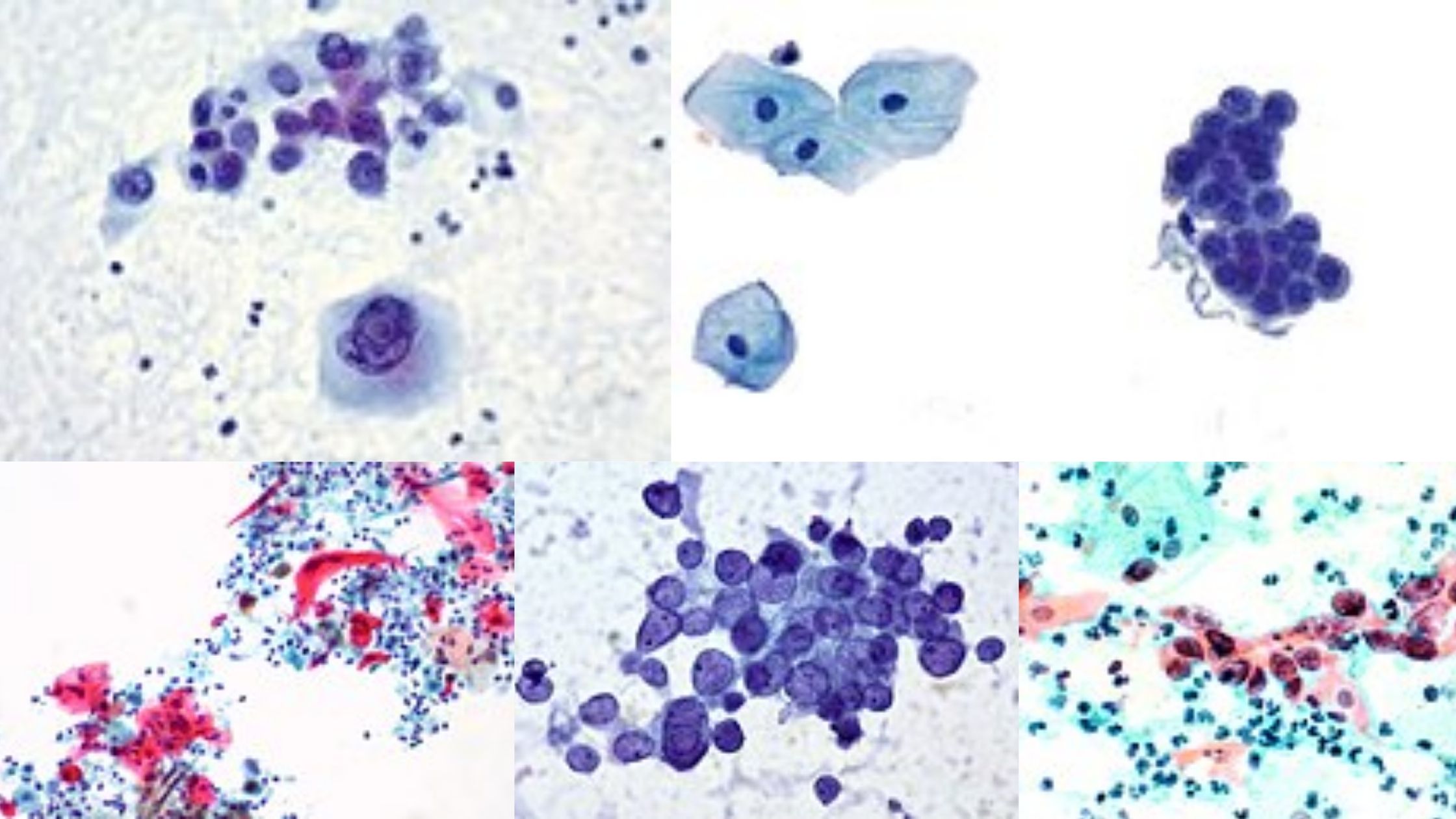 Papanicolaou Staining (Pap stain)