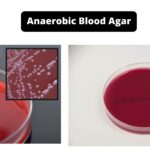 Anaerobic Blood Agar - Composition, Principle, Preparation, Results, Uses