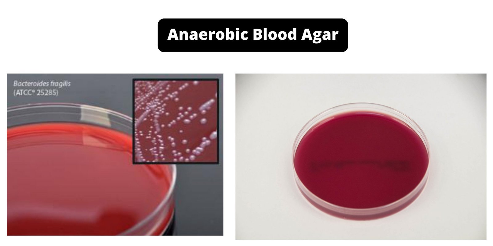 Anaerobic Blood Agar - Composition, Principle, Preparation, Results, Uses