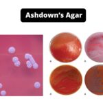 Ashdown’s Agar - Composition, Principle, Preparation, Results, Uses
