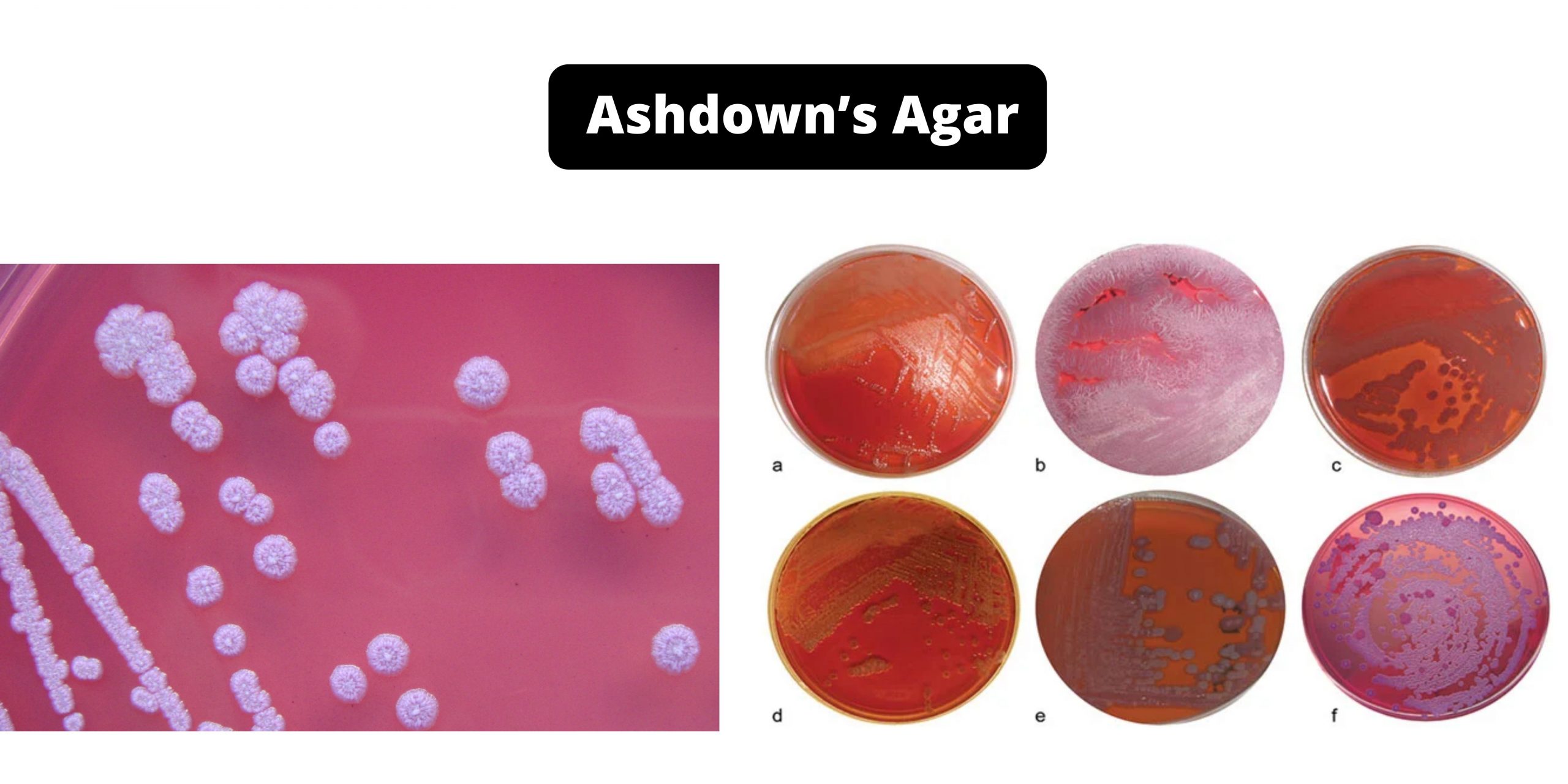 Ashdown’s Agar - Composition, Principle, Preparation, Results, Uses