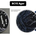 BCYE Agar - Composition, Principle, Preparation, Results, Uses