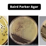 Baird Parker Agar - Composition, Principle, Preparation, Results, Uses