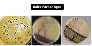 Baird Parker Agar – Composition, Principle, Preparation, Results, Uses